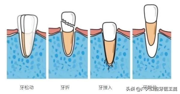 牙疼想知道自己是哪种牙疼,牙疼也算病一招解决绝对有效