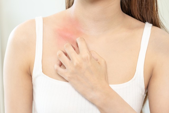 吃了退烧药过敏起皮疹严重吗,吃退烧药过敏还能吃吗