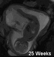 怀孕25周左右的宝宝,孕二十五周胎儿跟什么一样大