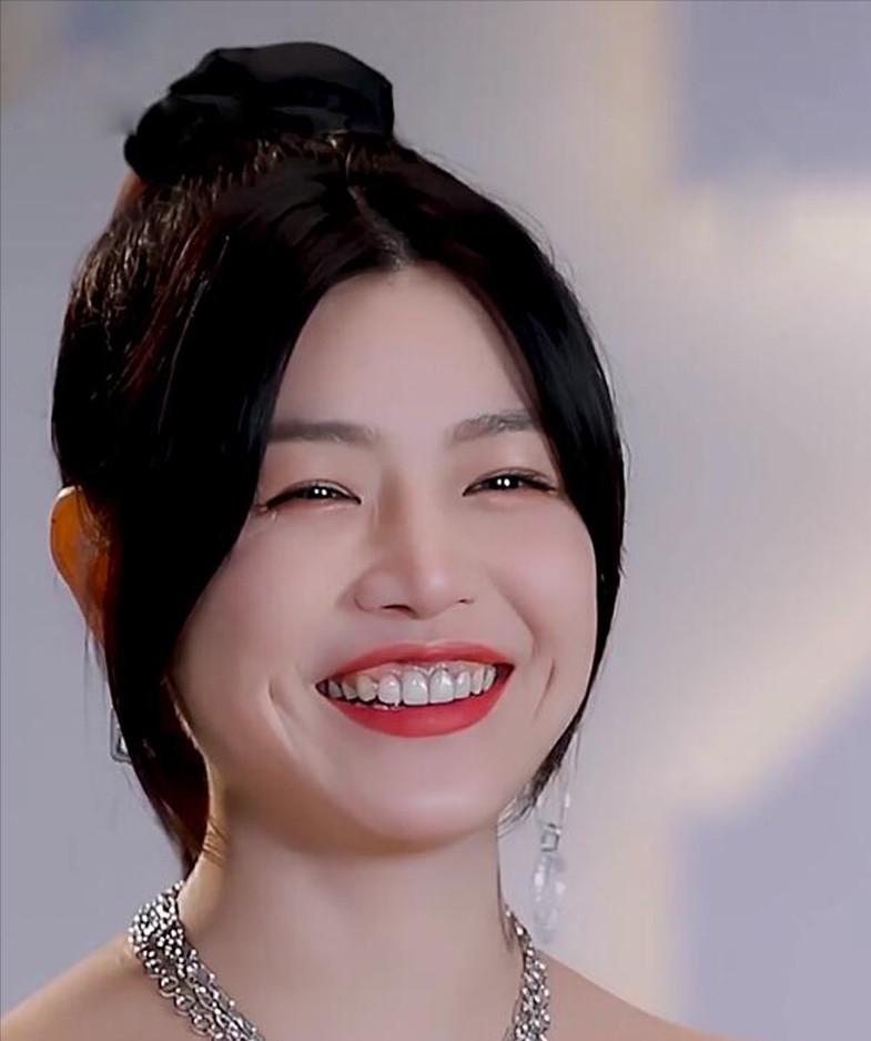 娱乐圈女星龅牙露一颗牙,娱乐圈的假牙女星