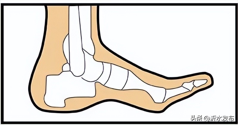 从腰痛转到脚痛是什么原因,肩痛腰疼脚丫痛什么原因