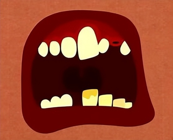 牙周病什么样的,牙周病是什么样的