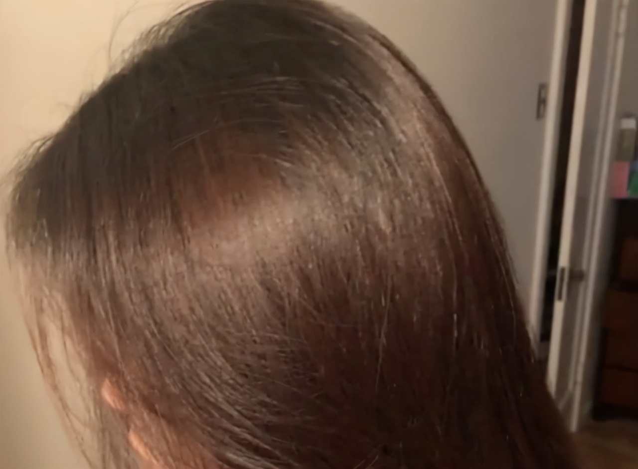 用蜂花护发素做水疗要先洗头吗,女子用蜂花护发素