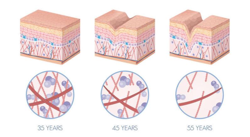美容院胶原蛋白抗衰有效果吗,胶原蛋白肽抗衰第一名