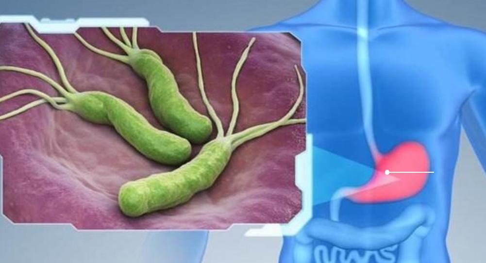 胃溃疡反复发作如何治疗,胃溃疡治好后如何保养