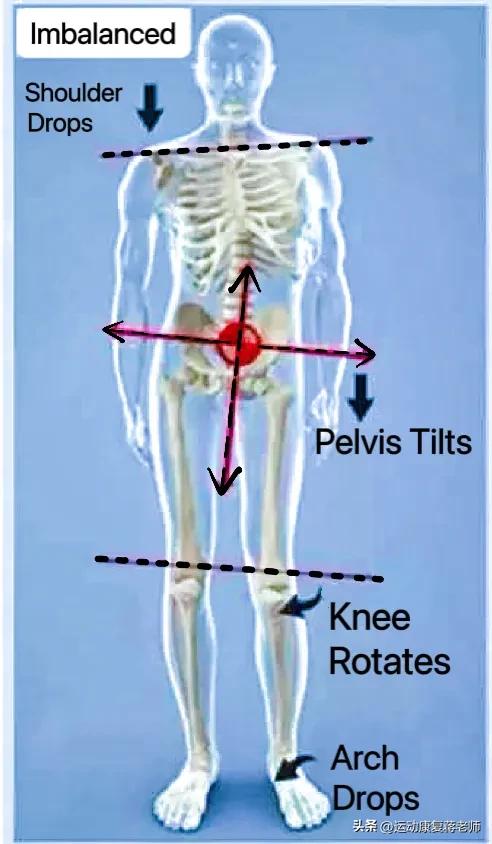 脖子歪左边怎么矫正,脖子歪了睡觉应该注意啥姿势