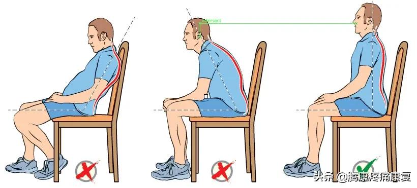 平背的成因,平背怎么造成的