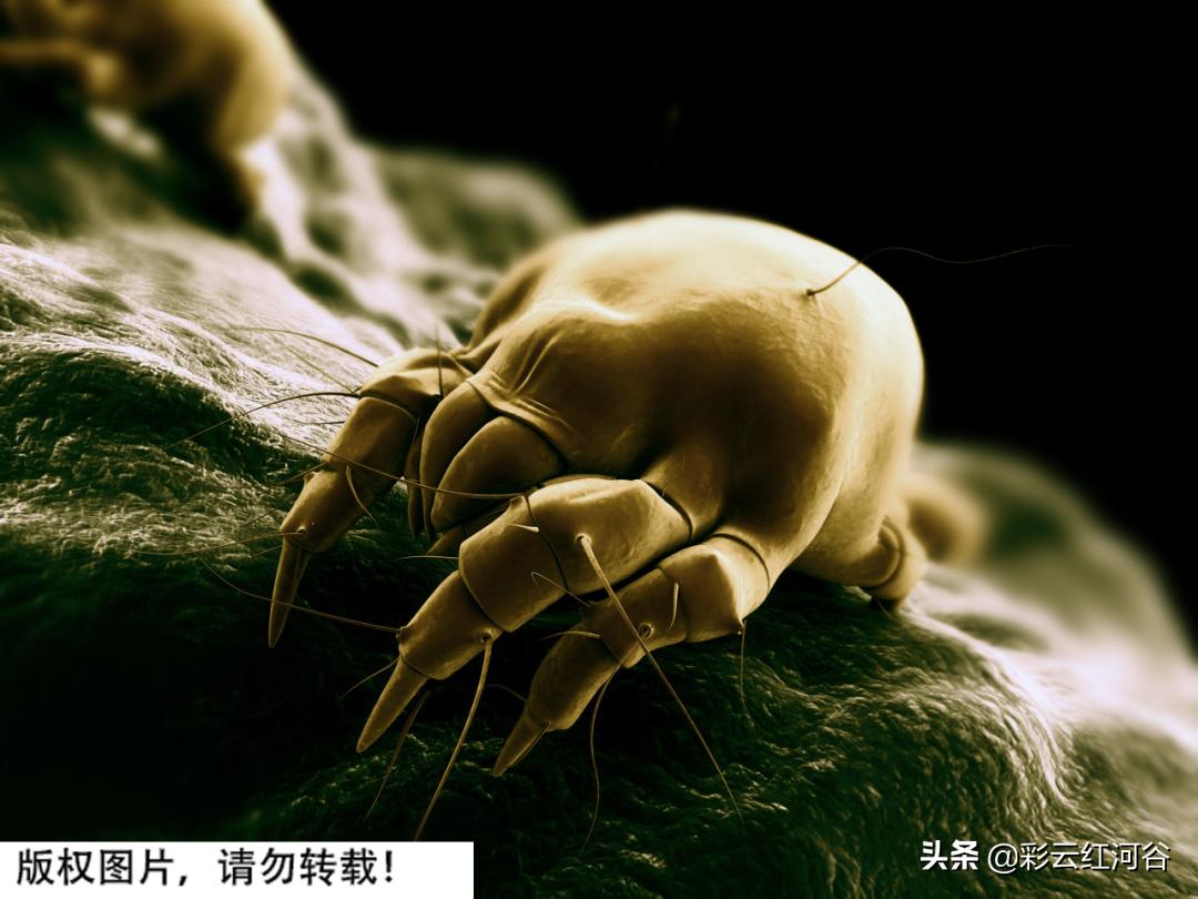 眼睛干涩发痒有虫,女子眼干去医院检查后发现螨虫