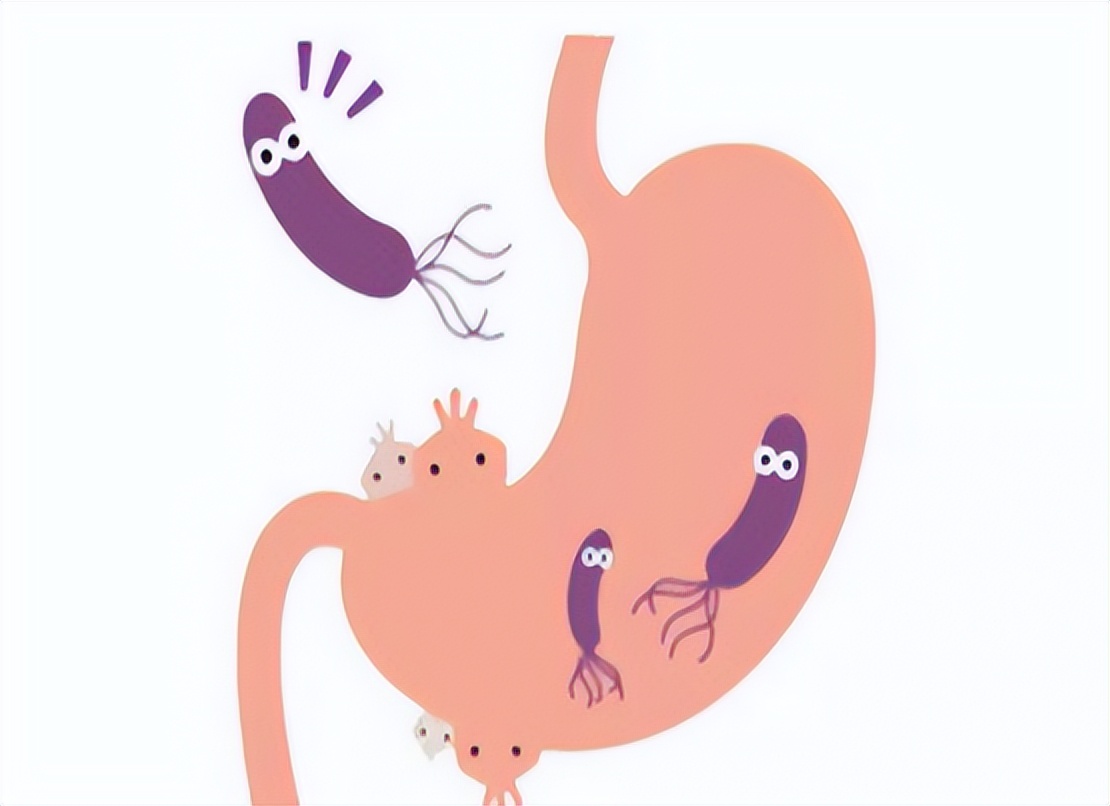 日本胃癌患病率为什么那么高,中国和西方国家患癌比例