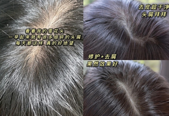 孕期好用的洗发水推荐,适合孕期使用的洗发水推荐