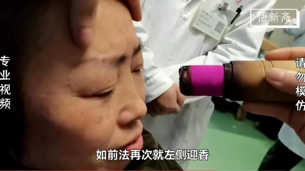 雷火灸治鼻炎怎么操作,雷火灸鼻炎灸视频