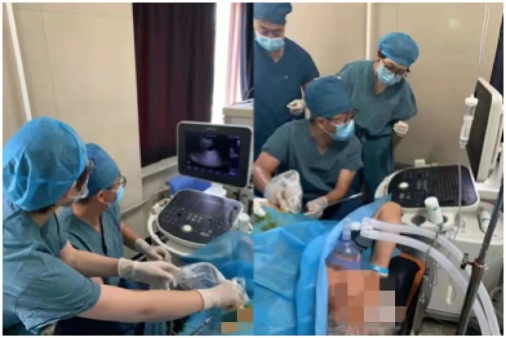 超声引导下胆囊穿刺术操作经过,超声引导下胆囊穿刺引流术动画