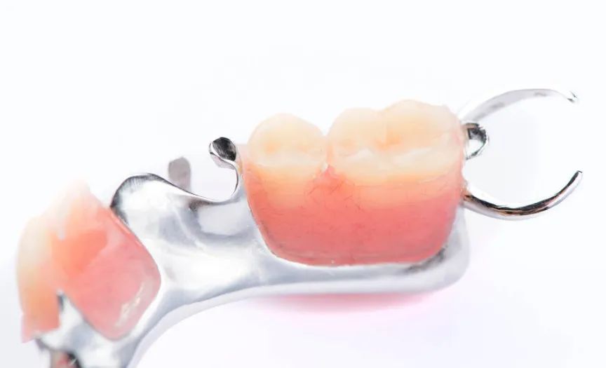 缺一颗牙是镶牙好还是种牙好,老年人缺4颗种牙好还是镶牙好