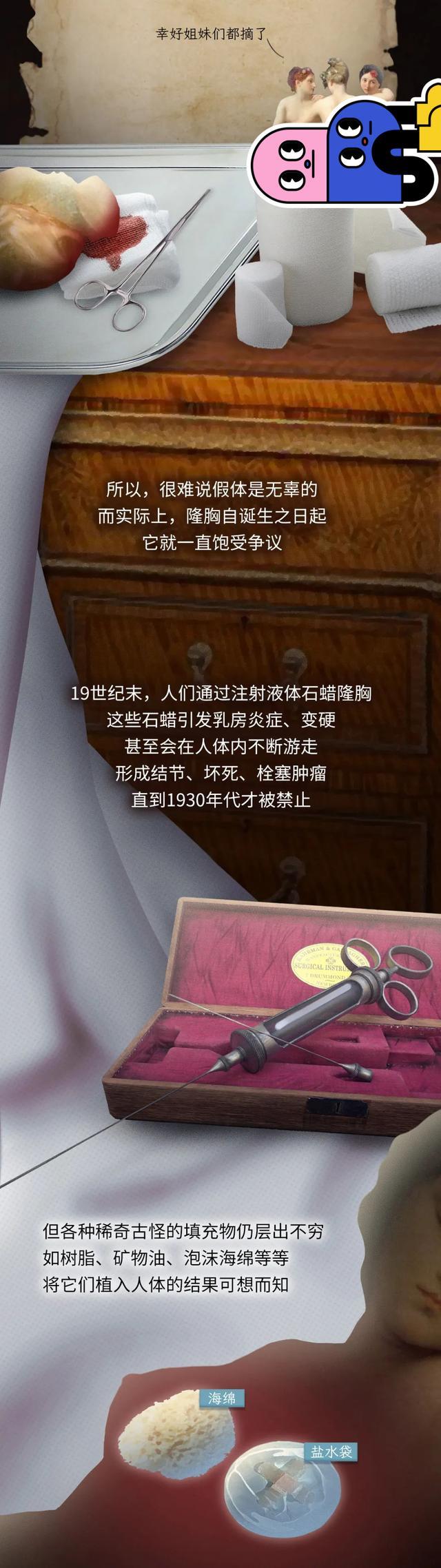 第一批假体隆胸的人现在如何,第一批脂肪隆胸的人现在怎么样