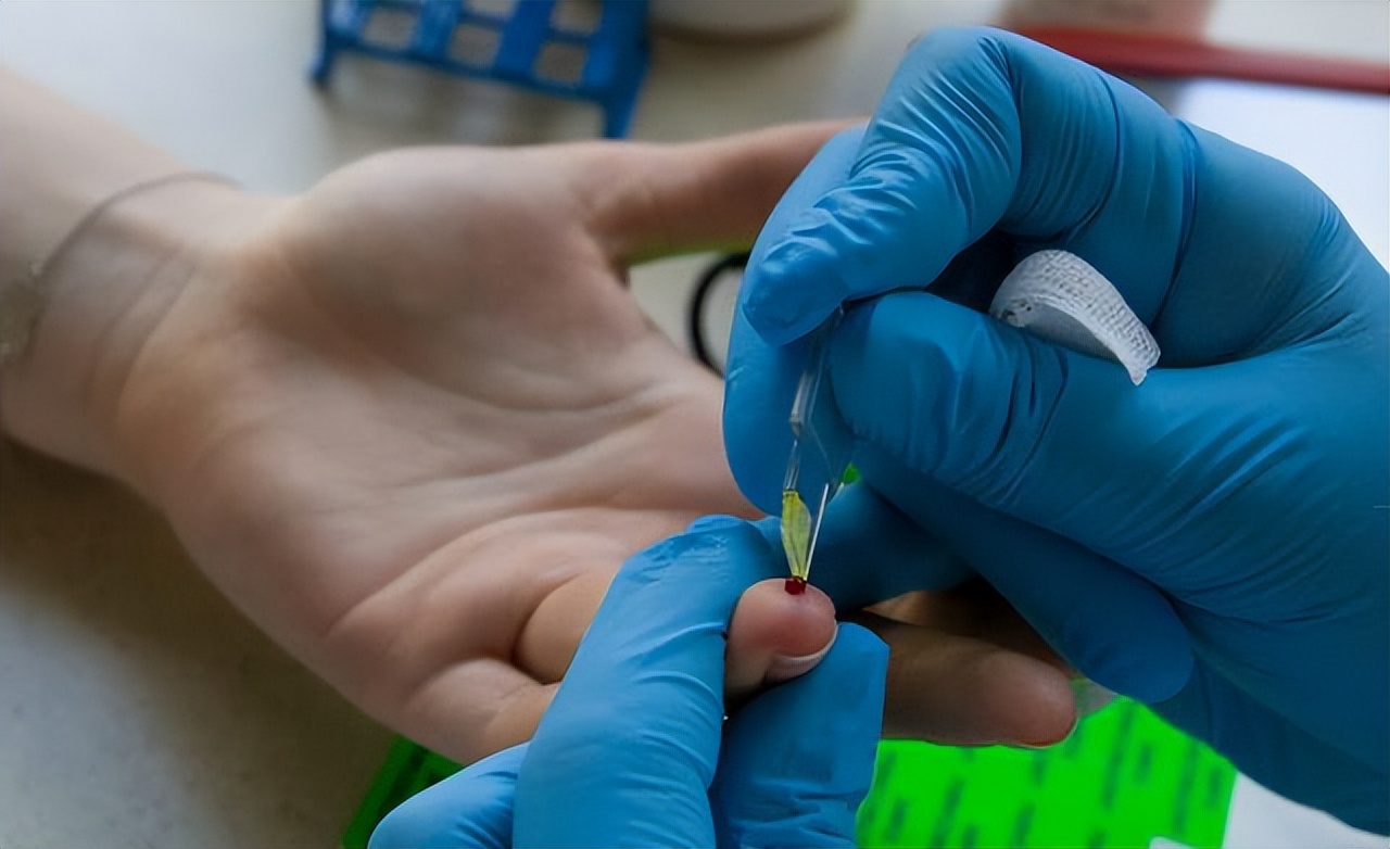 贫血缺铁怎么治疗,贫血缺铁需要怎样医治