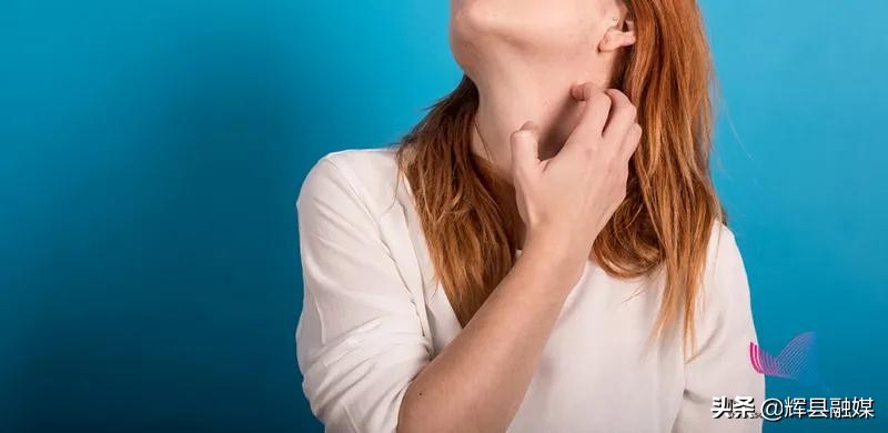 河南辉县丨为什么一到冬天就浑身瘙痒？别挠！缓解办法拿走不谢辉县市融媒体中心