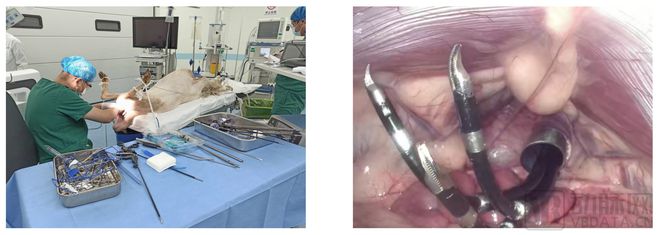 体内柔性手术机器人,首台介入手术机器人