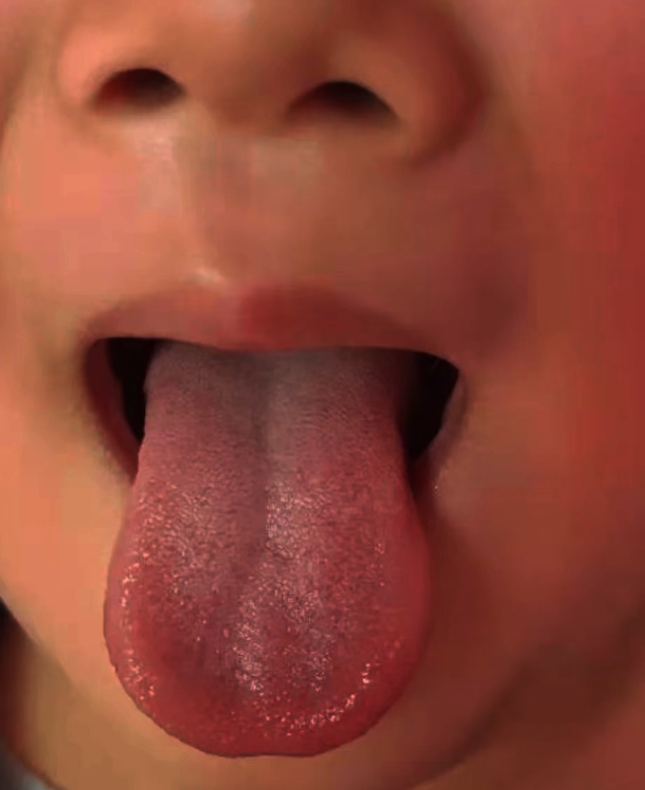 6岁儿童老生病,宝宝一岁八个月不长肉只长高