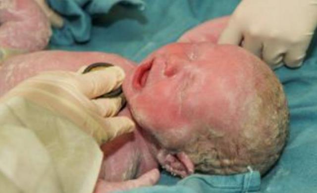 宝宝出生后,身上全是“白色巧克力”,网友:孕期“坏事”做多了