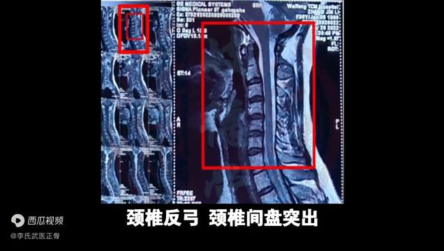 中医科普视频“人的支柱——脊柱·颈椎篇”岐德堂中医骨科出品