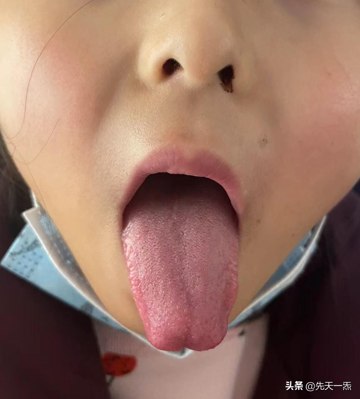 常见腹痛诊疗思路,伤寒论经方治顽固性腹痛