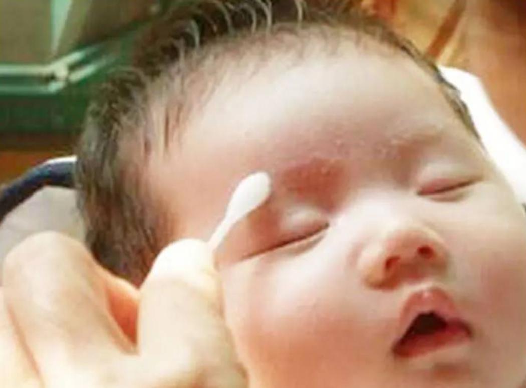 两个月宝宝脸上长小红痘痘痒,两个月宝宝用了面霜长痘痘了
