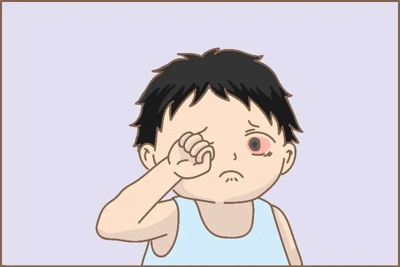 近期高发红眼病,提醒家长红眼病预防
