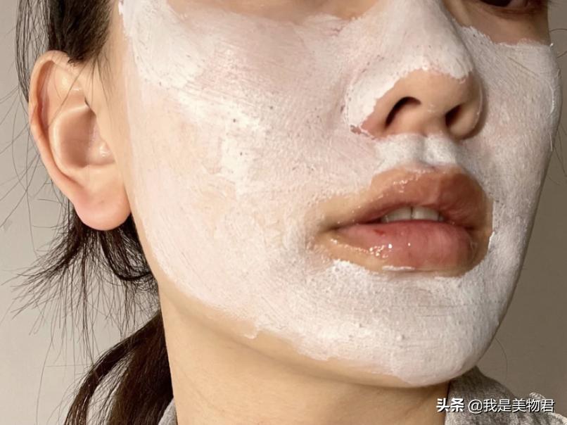 改善毛孔堵塞闭口粉刺,毛孔清道夫去闭口粉刺