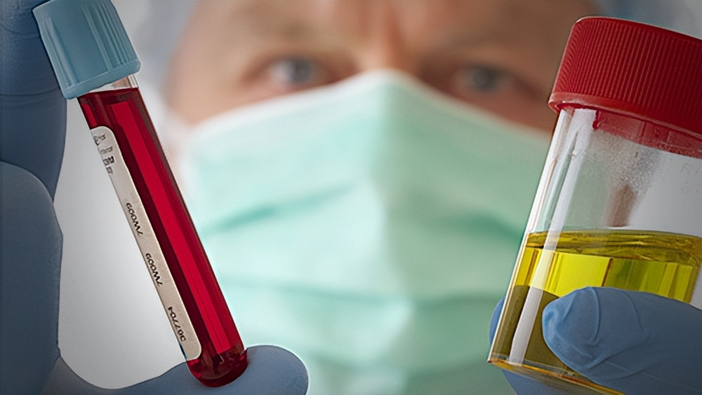 拉血尿血怎么回事男性,男性睾丸疼尿血怎么回事