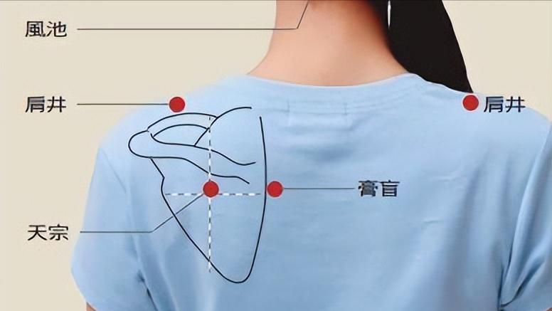面瘫口眼歪斜怎么治疗最好,中风面瘫口眼歪斜怎么治