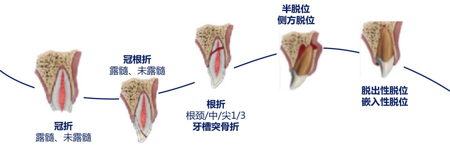 牙齿受外伤吃什么对牙好,牙齿受损伤引起牙痛怎么办