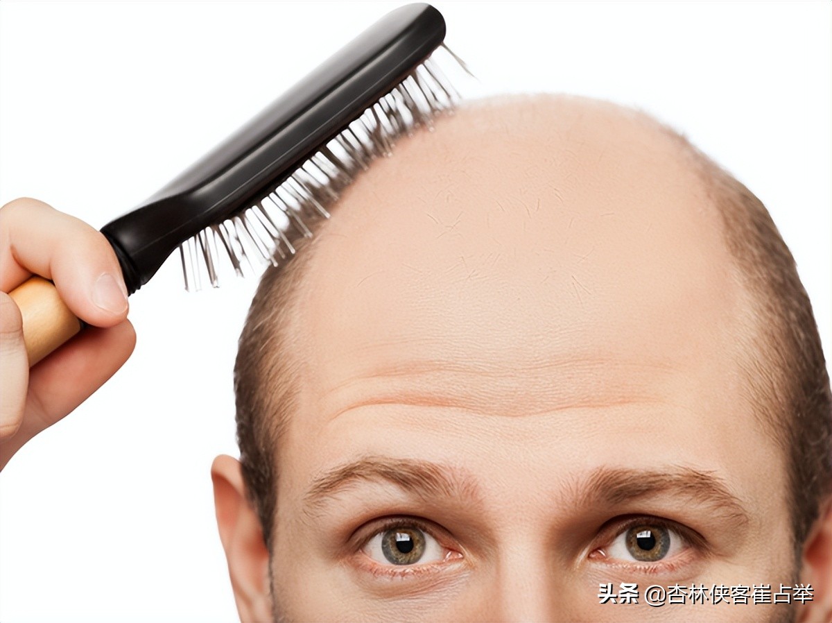 脱发一小块治疗最快的方法,脱发严重头发快全秃了怎么办