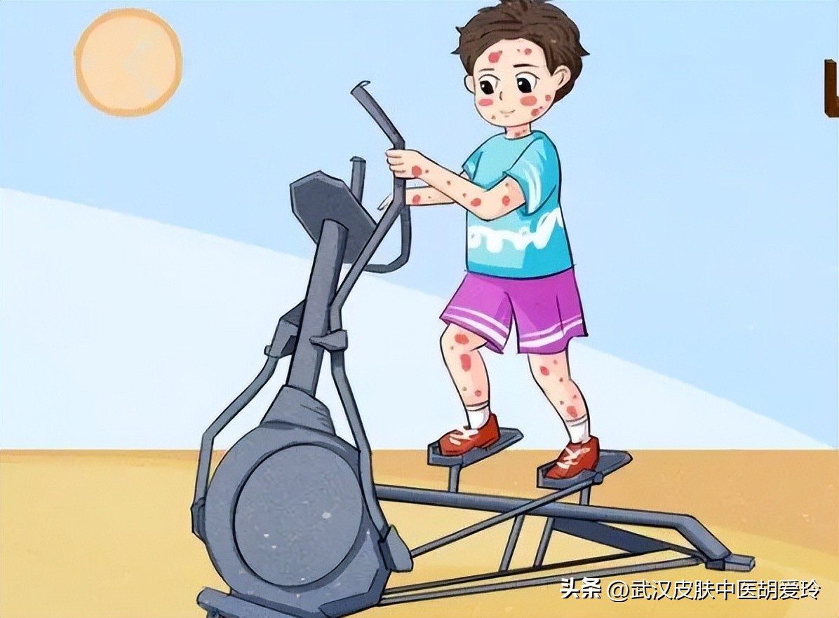 腿上有一块起皮干燥不痒,腿上有一小块皮肤反复脱皮