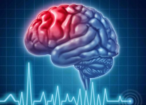 中医对中风的认知和康复方法,脑中风跟癫痫有什么区别