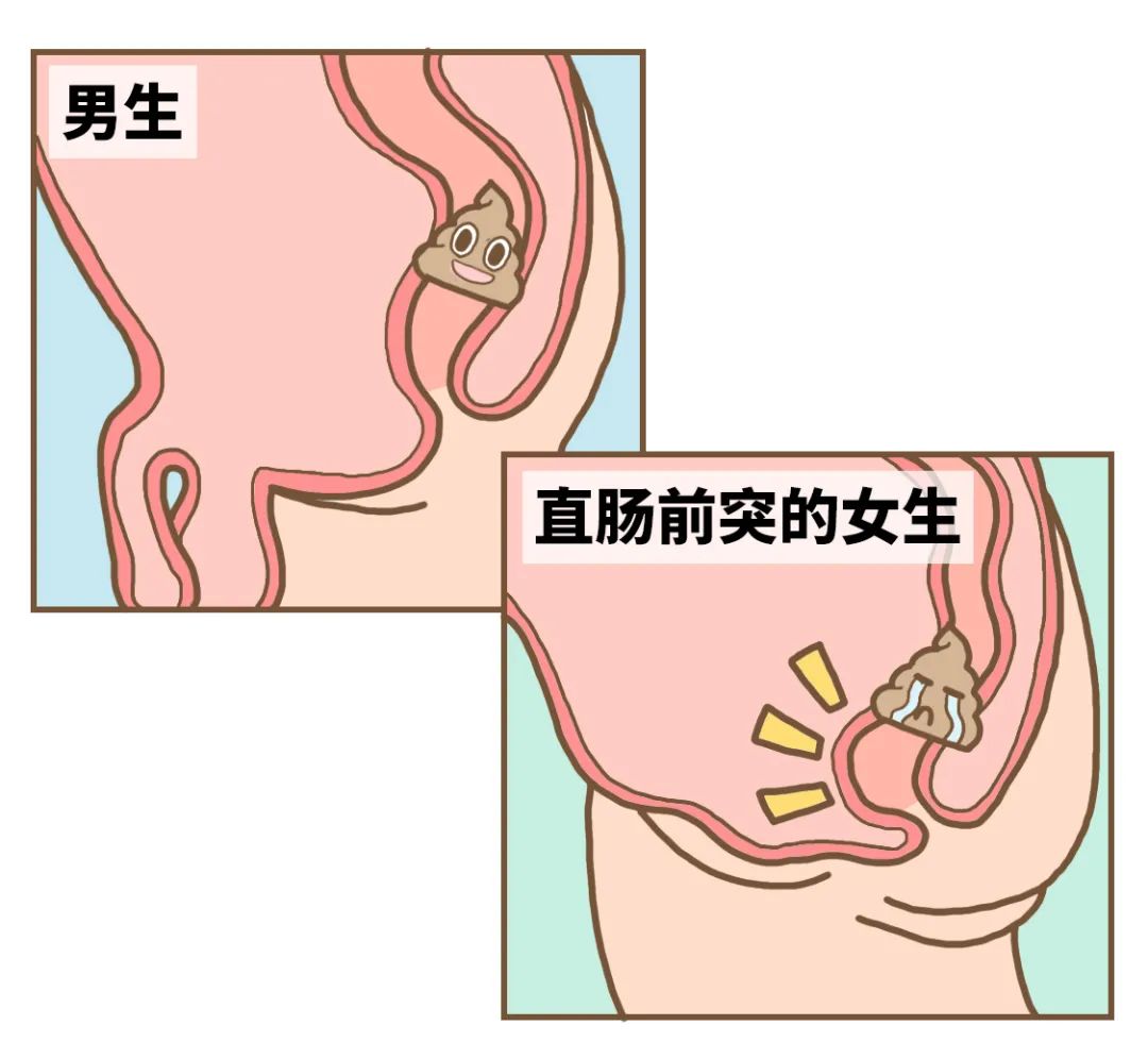 拉屎这件事,男人从来没有输过