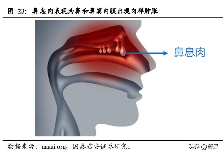 康诺亚生物制剂,康诺亚深度分析