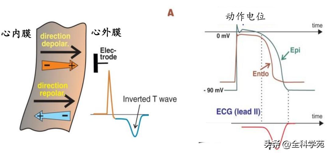 t波倒置三种常见原因,t波低平倒置有事吗