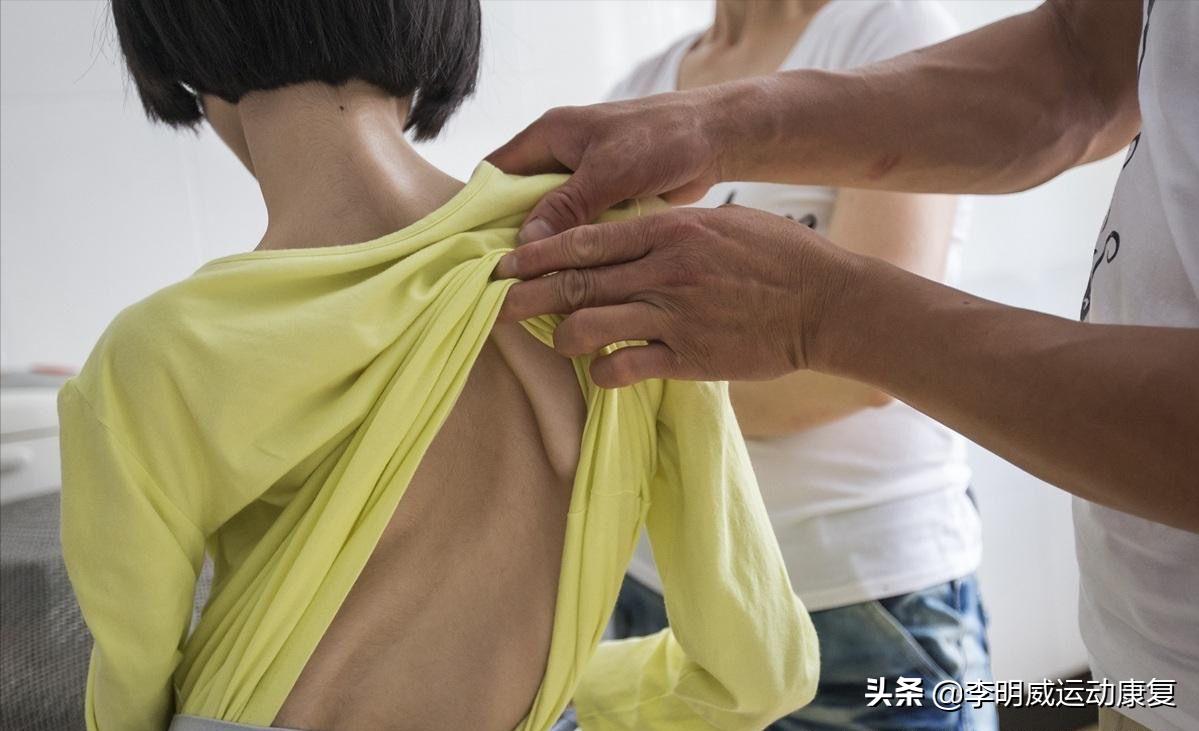 14岁脊柱向左侧弯13度要怎么矫正,14岁脊柱侧弯40度不治疗会加重呀