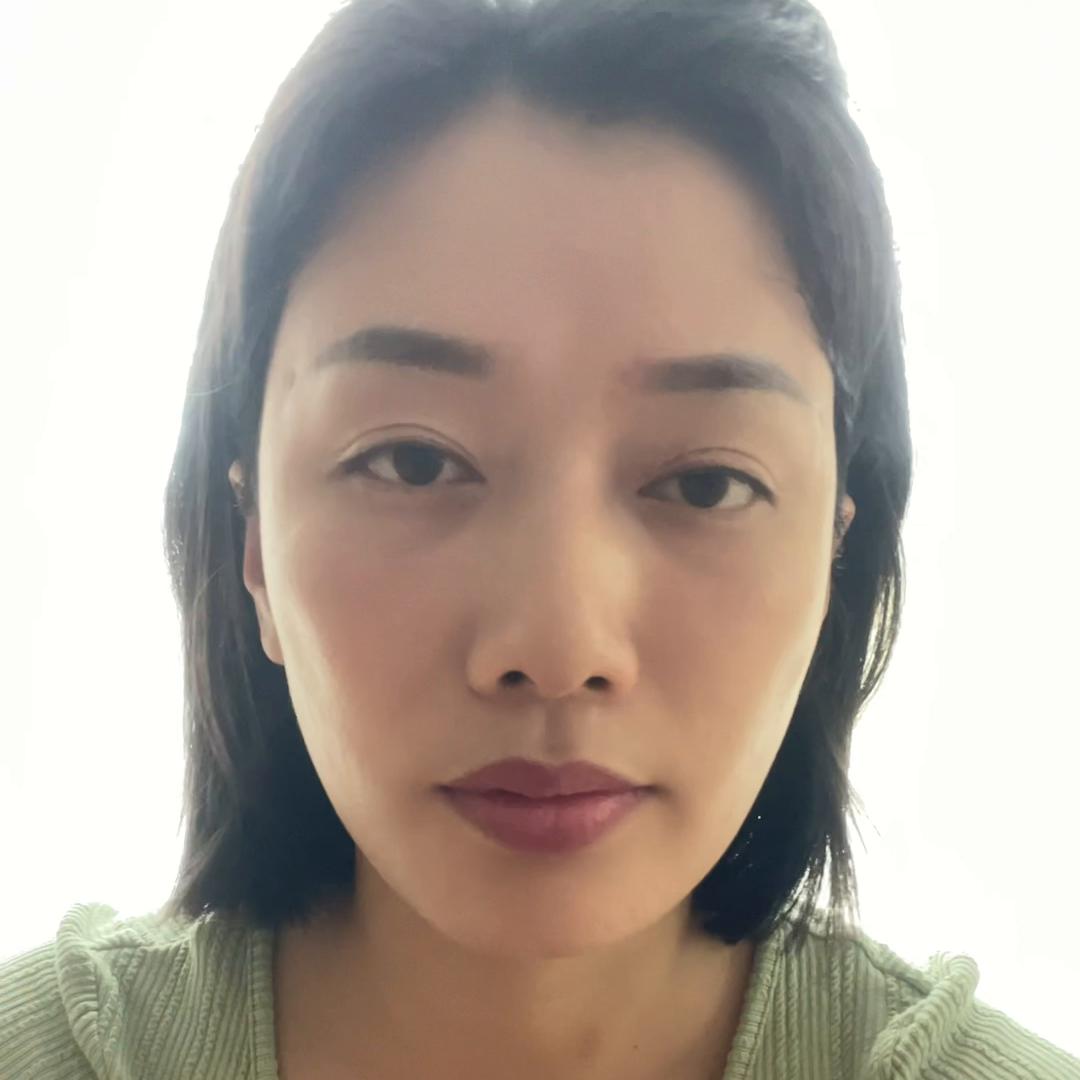 眼肌下垂怎么改善,改善眼部肌肉下垂让眼睛变有神