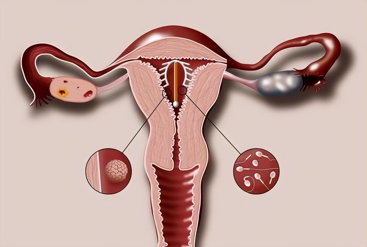 第一批女性上环的结局,中国女性上环