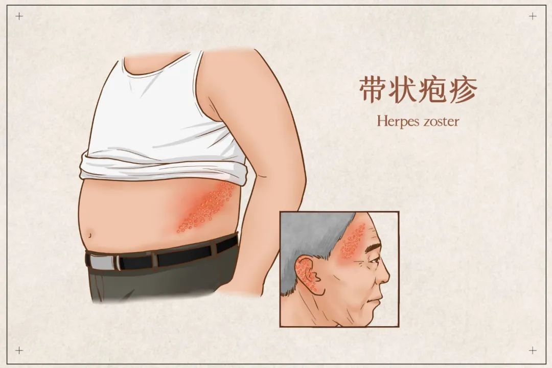 栖霞大伯腰盘长龙