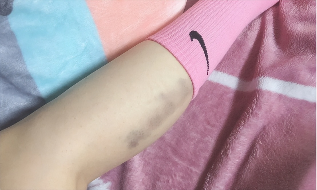 筋膜枪的危害使用中的五大误区,筋膜枪的好处与坏处