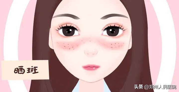 25岁女生长期熬夜长出老年斑,女生长期熬夜长老年斑怎么调理