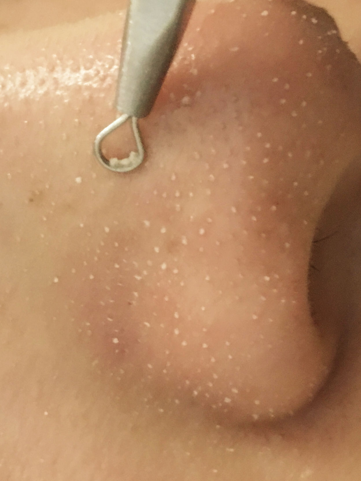 为什么越来越多的人去做美容,为什么越来越多的人去美容院