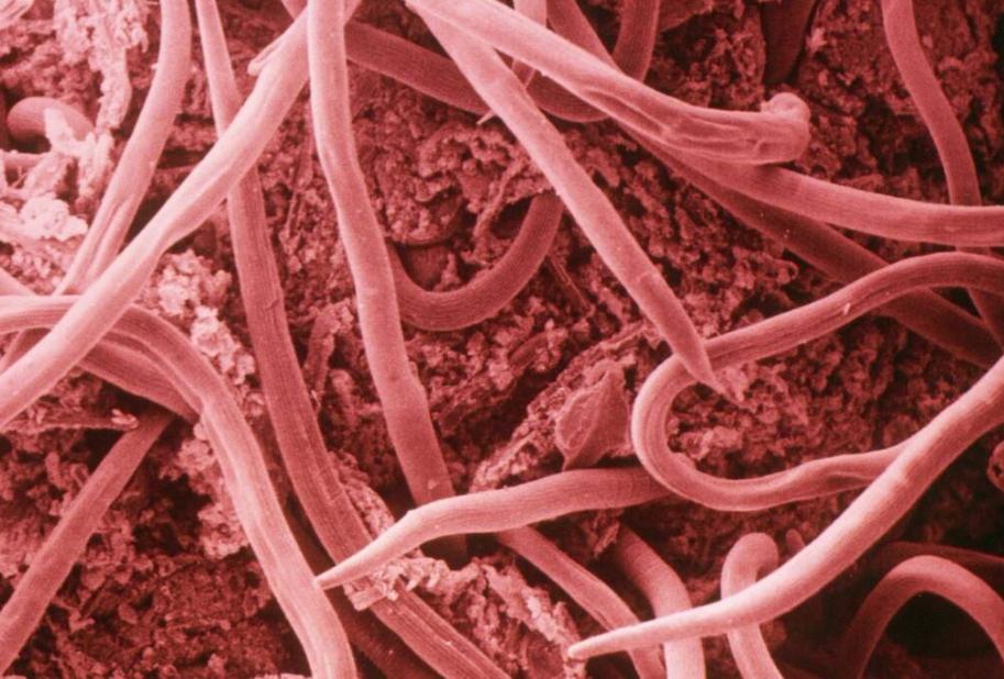 千万要注意六种寄生虫多的食物,提醒6种食物是寄生虫的重灾区