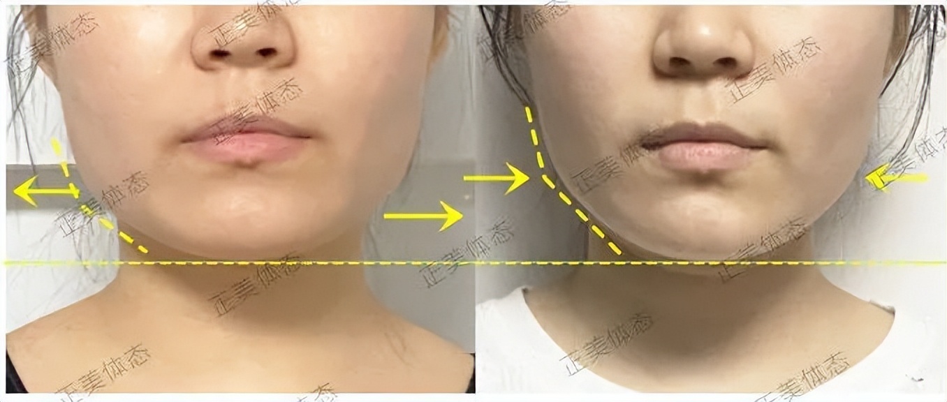 精致小脸的10个方法,精致脸如何变美