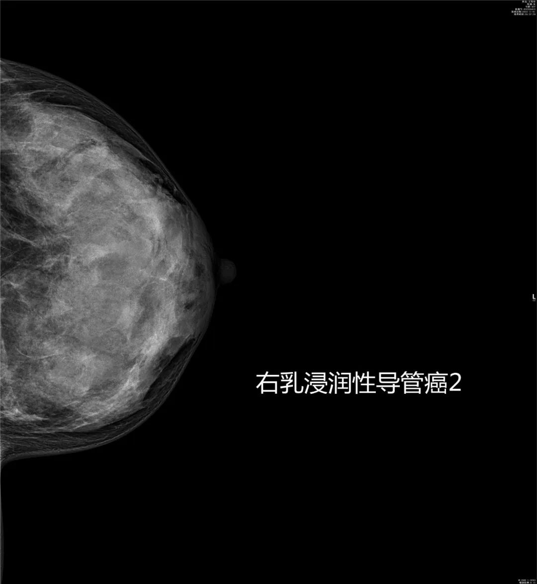 致敬公司的摄影师,美女致敬摄影师视频