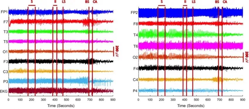 中国最著名的濒死体验研究者是,中国最著名的濒死体验研究者