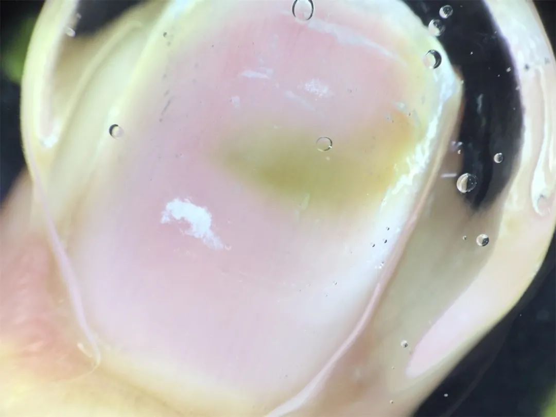 指甲上长了绿霉菌和美甲店有关吗,美甲导致指甲发绿