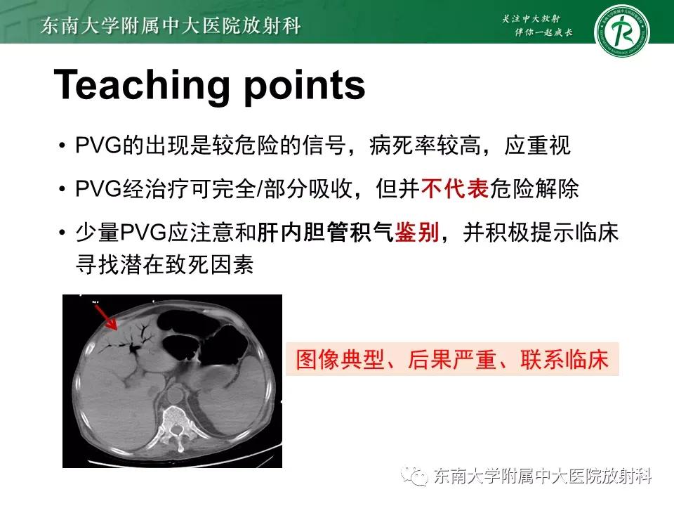 门静脉积气什么意思,好文分享深度揭秘